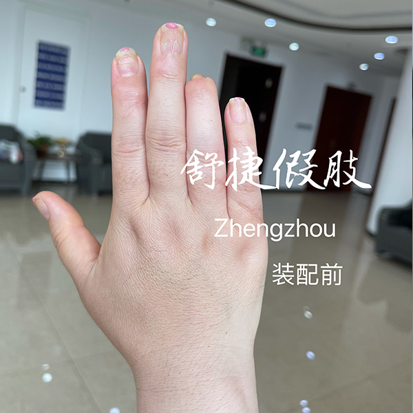 美容假手指裝配前.jpg